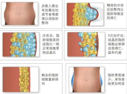 再生pe溶脂指数,再生pe溶脂指数是什么 -第2张图片-济宁荣昌木业网